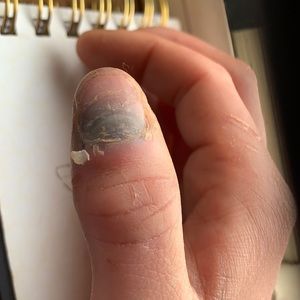 In case you wrote wondering why I’m slow today